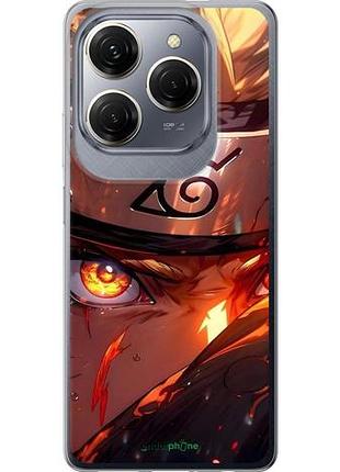 Чехол на tecno spark 20 pro наруто