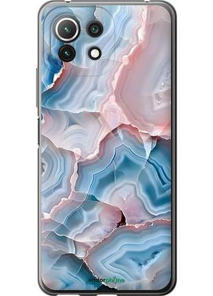 Чехол на xiaomi mi 11 lite мрамор сяоми ми 11 лайт