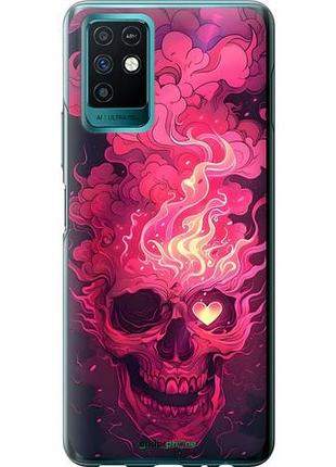 Чехол на infinix note 10 череп арт инфикс ноут 10