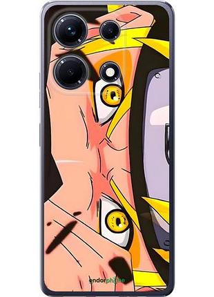 Чехол на infinix note 30 наруто naruto 2 инфикс ноут 30 2