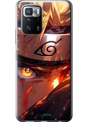 Чехол на xiaomi poco x3 gt наруто naruto сяоми поко х3 гт