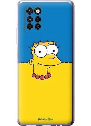 Чехол на infinix note 10 pro мардж флаг украины инфикс ноут 10 про