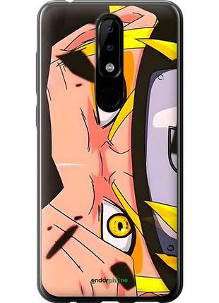 Чехол на nokia 5.1 plus наруто naruto 2 нокиа 5.1 плюс 2