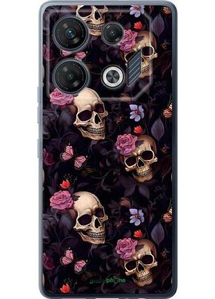 Чохол на infinix gt 10 pro черепа та троянди