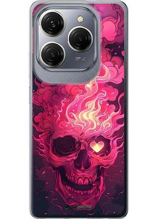 Чехол на tecno spark 20 pro череп арт
