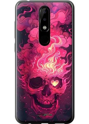 Чохол на nokia 5.1 plus череп арт