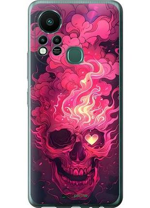 Чехол на infinix hot 11s череп арт инфикс хот 11с