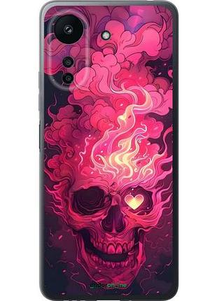 Чехол на xiaomi poco c65 череп арт сяоми поко с65