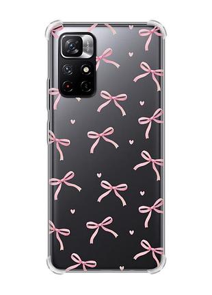 Чохол з потовщеними кутами на xiaomi redmi note 11 5g бантики (принт 404)