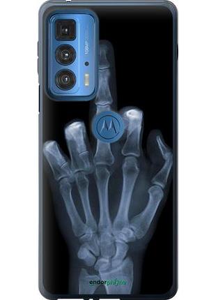 Чехол на motorola edge 20 pro рука через рентген "1007u-2662-10746"