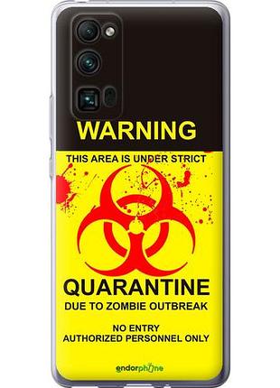 Чехол на huawei honor 30 pro biohazard 9 "4825u-1920-10746"