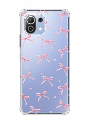 Чехол с утолщёнными углами на xiaomi mi 11 lite бантики (принт 404)