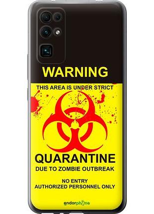 Чехол на huawei honor 30 biohazard 9 "4825u-1921-10746"