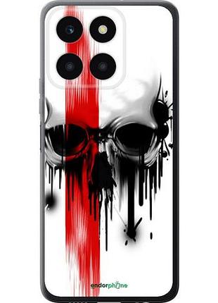 Чохол на huawei honor x6a biohazard 13 "4830u-3340-10746"