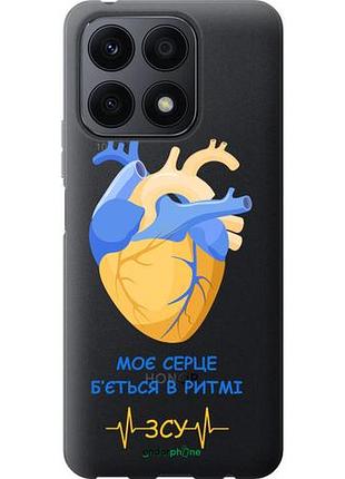 Чехол на huawei honor x8a сердце v2 "5296u-2963-10746"