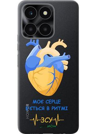 Чохол на huawei honor x6a серце v2 "5296u-3340-10746"