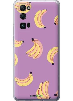 Чехол на huawei honor 30 pro бананы "4312u-1920-10746"