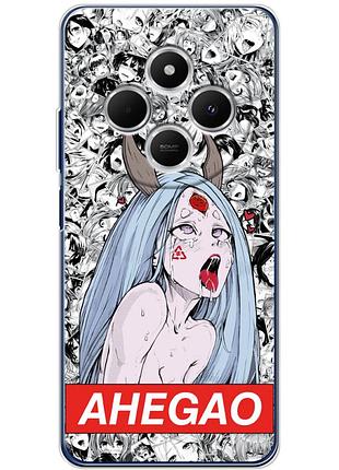 Чохол силіконовий з картинкою на xiaomi redmi a4 (аніме, anime)
