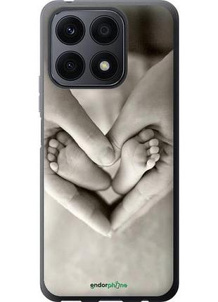 Чехол на huawei honor x8a любовь "699u-2963-10746"