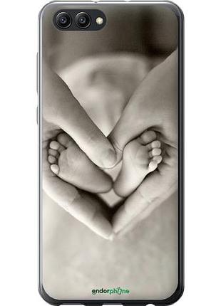 Чохол на huawei honor v10 / view 10 любов "699u-1579-10746"