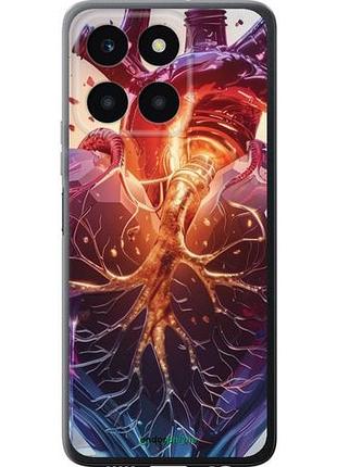 Чохол на huawei honor x6a crystal heart "6070u-3340-10746"