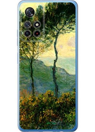 Чехол на xiaomi redmi note 11 5g клод моне "1193u-3849-2448"