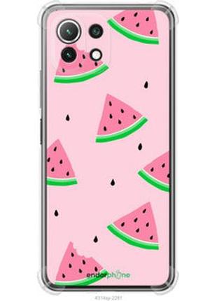 Чехол на xiaomi mi 11 lite розовый арбуз "4314sp-2281-2448"