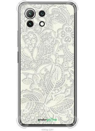 Чохол на xiaomi mi 11 lite біле мереживо "4383sp-2281-2448"