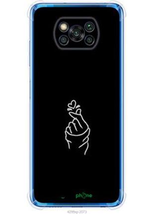 Чехол на xiaomi poco x3 love you "4298sp-2073-2448"