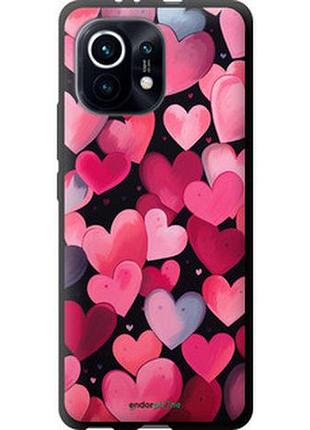 Чехол на xiaomi mi 11 сердечки 4 "5662b-2253-2448"