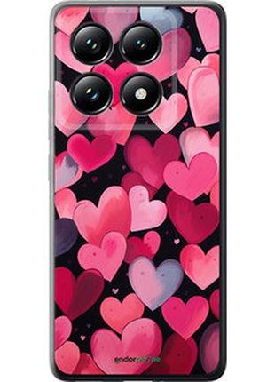 Чехол на xiaomi 14t pro сердечки 4 "5662u-3806-2448"