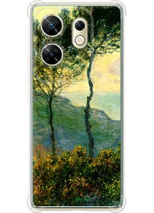 Чохол на infinix zero 30 4g клод моне "1193sp-3413-2448"