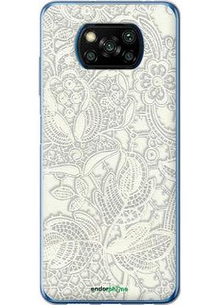 Чехол на xiaomi poco x3 белое кружево "4383u-2073-2448"