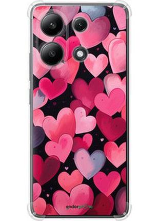 Чехол на xiaomi redmi note 13 4g сердечки 4 "5662sp-3654-2448"