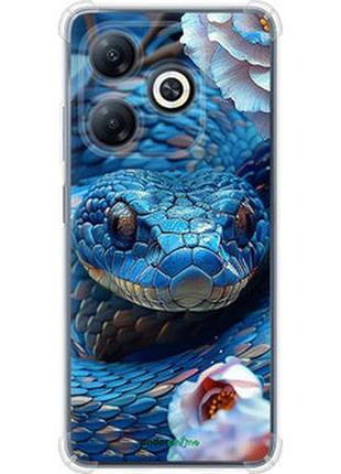 Чохол на tecno spark 20 blue snake "6079sp-3435-2448"