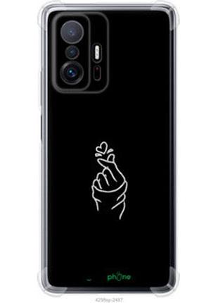 Чехол на xiaomi 11t pro love you "4298sp-2552-2448"