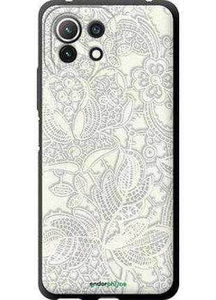 Чехол на xiaomi mi 11 lite белое кружево "4383b-2281-2448"