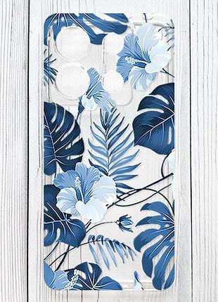Прозрачный чехол на xiaomi redmi 15c тропики (принт 373)