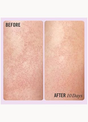 Скраб для тіла kp bump eraser body scrub with 10% aha first aid beauty