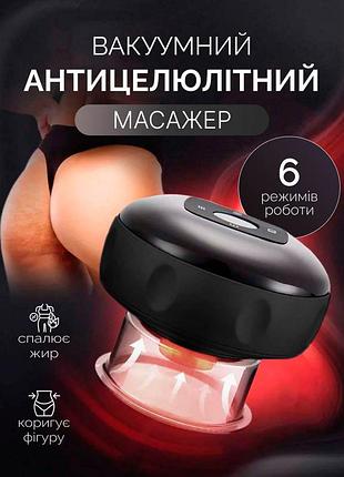 Вакуумный массажер антицеллюлитный с подогревом аппарат для коррекции фигуры массажная банка для похудения