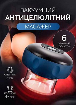 Вакуумный антицеллюлитный массажер с подогревом, массажная антицеллюлитная банка blue