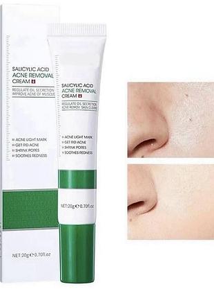 Крем для обличчя антиакне із саліциловою кислотою - bioaqua salicylic acid acne removal cream 20g