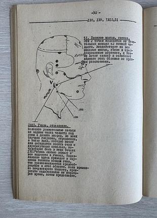Акупунктура без иголок