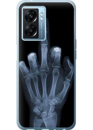 Чехол на oppo a77 5g рука через рентген из силикона fch_0152496