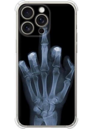 Чехол на iphone 15 pro max рука через рентген из силикона fch_0152572