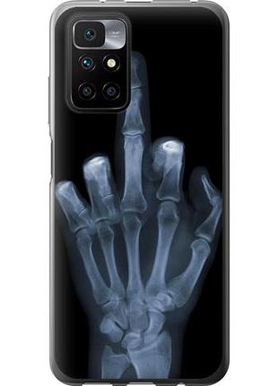 Чехол на xiaomi redmi 10 рука через рентген из силикона fch_0007836