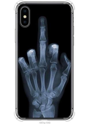 Чехол на iphone x рука через рентген из силикона fch_0152562