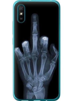 Чехол на xiaomi redmi 9a рука через рентген из силикона fch_0007872