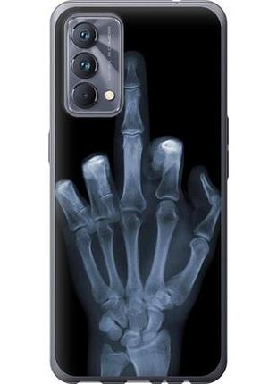 Чехол на realme gt master рука через рентген из силикона fch_0152506