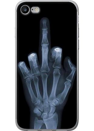 Чехол на iphone 7 рука через рентген из пластика fch_0152491